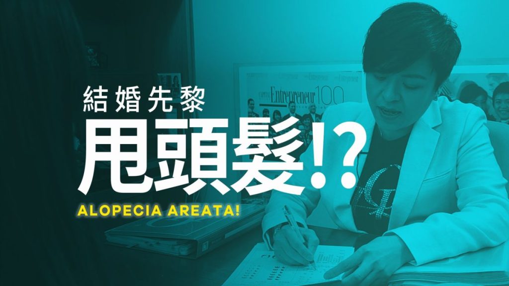 Alopecia Areata
